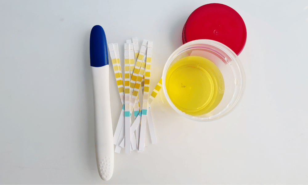 Components of Urine Relevant to Pregnancy Tests